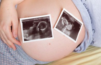 Sindrome da trasfusione feto-fetale nelle gravidanze gemellari monocoriali
