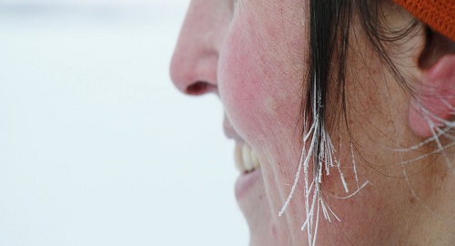 proteggere la pelle dal freddo in modo naturale