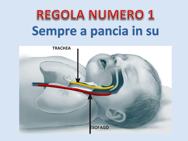 Per ridurre i rischi di soffocamento per rigurgito nel sonno, in quale posizione devono dormire i neonati