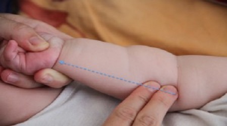 massaggio pediatrico tuina febbre