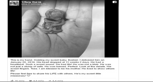 aborto spontaneo foto 11 settimane