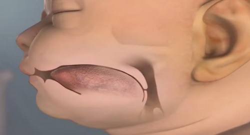 posizione della bocca del bimbo allattamento