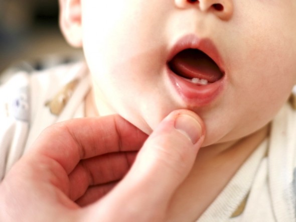 Rimedi omeopatici per la dentizione neonati