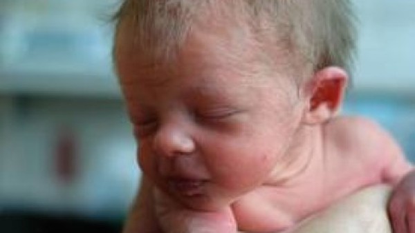 macchioline bianche miglio dei neonati