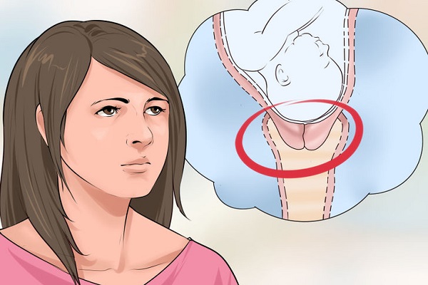 dilatazione della cervice