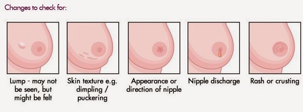 Cancro al seno: 7 segnali da non sottovalutare