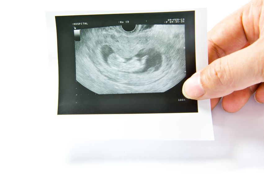 Non c'è più battito - i subdoli sintomi dell'aborto in utero.