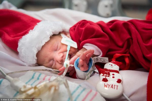 terapia intensiva neonatale del Texas Children's Hospital di Houston 