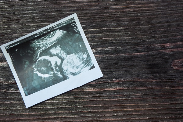 Seconda gravidanza di Belen: svelati importanti particolari